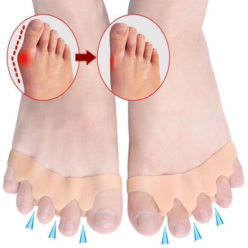 CozyStep™ Toe Separator: Say Goodbye to Hallux Valgus! - Montero Milan